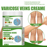 Blue Veins Bulging Pain Relief Leg Massage Cream 0 - Tophatter Daily Deals
