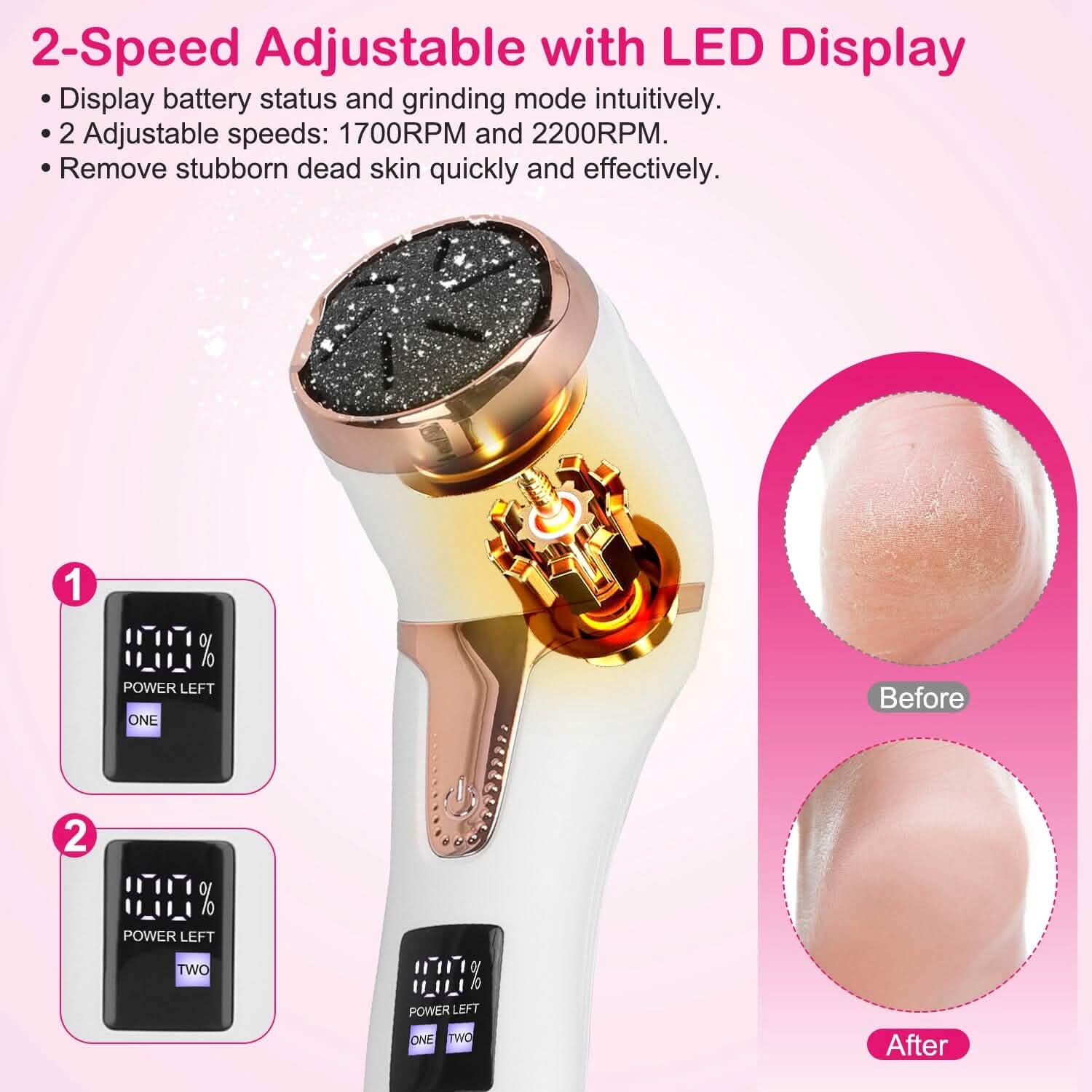 17-Pieces Set: Electric Foot Callus Remover with Vacuum Foot Grinder Rechargeable Beauty & Personal Care - Tophatter Daily Deals