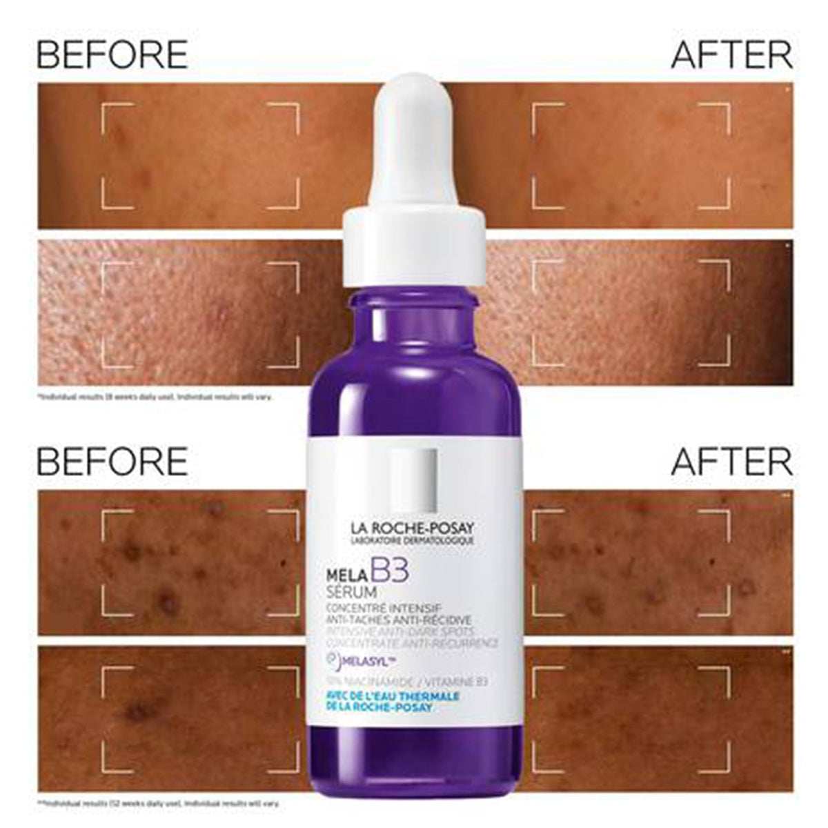 La Roche-Posay Mela B3 Serum 30ml Bottle - Tophatter Daily Deals