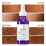 La Roche-Posay Mela B3 Serum 30ml Bottle - Tophatter Daily Deals