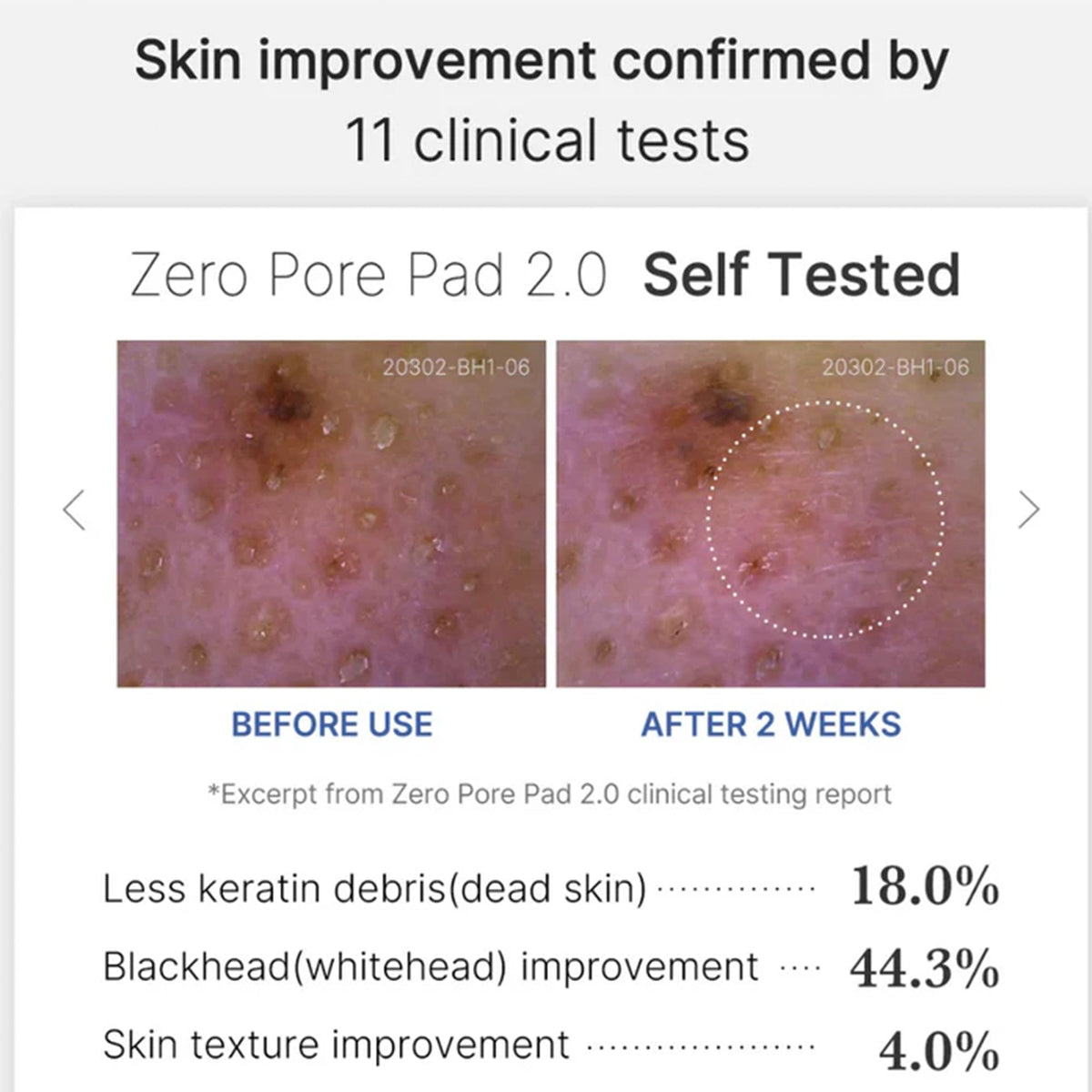 Medicube Zero Pore 2.0 Toner Pad 70pc Tub - Tophatter Daily Deals