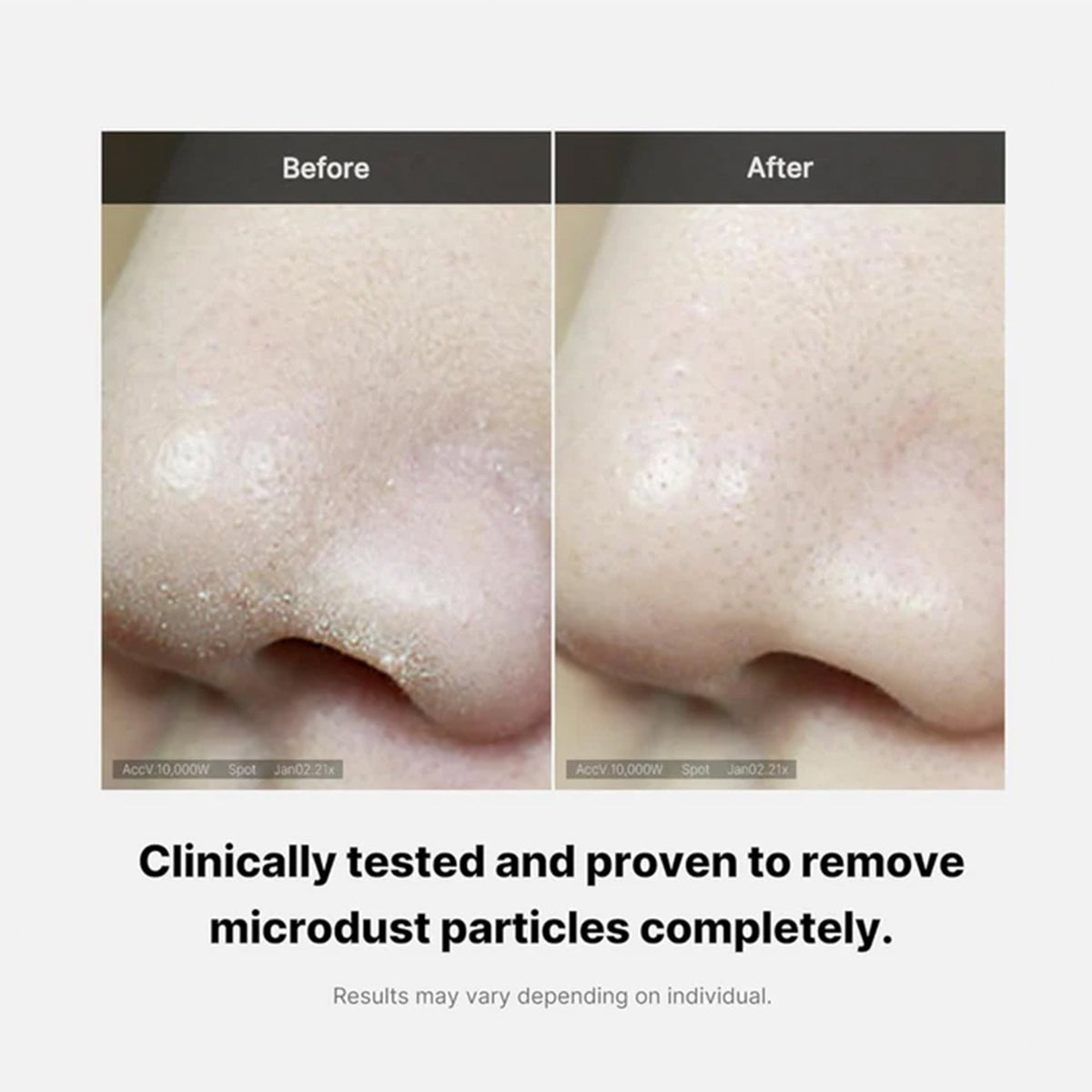 Medicube Zero Pore Foam Cleanser 120g Tube - Tophatter Daily Deals