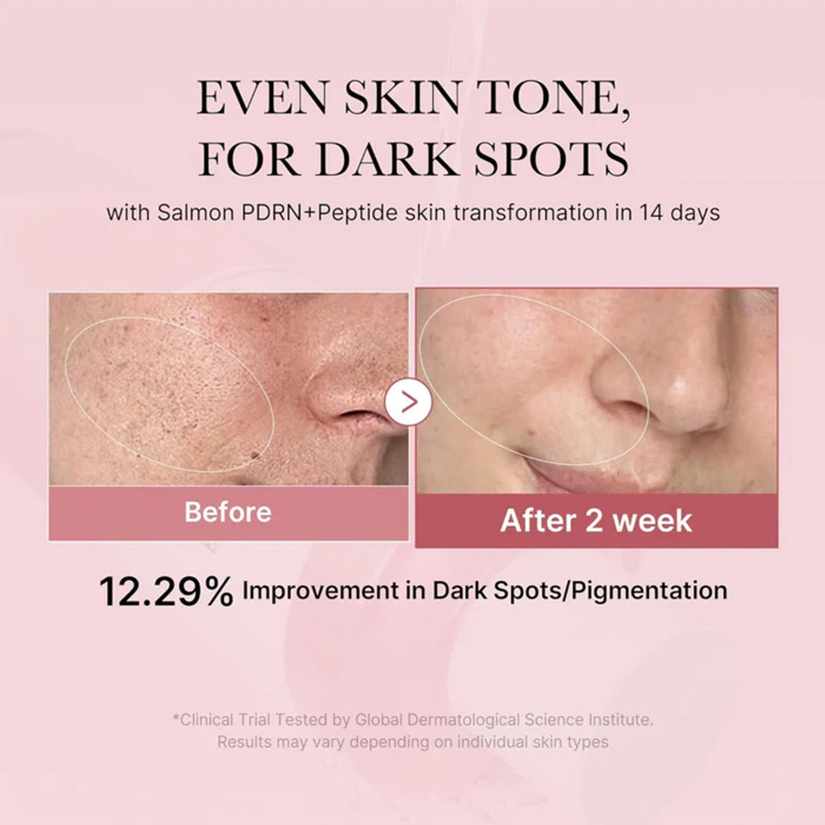Medicube PDRN Pink Collagen Toner 250ml Bottle - Tophatter Daily Deals
