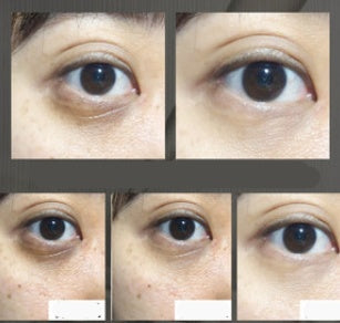 Anti wrinkle eye cream 0 - Tophatter Daily Deals