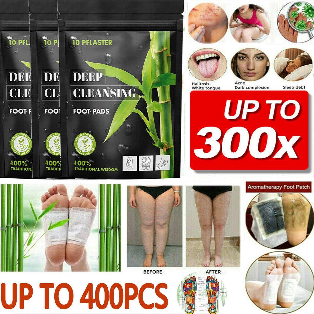 Toxin Pads for Feet - 200PCS Detox Patches Ginger Detox Foot Pads Toxin Removal Anti-Swelling Clean bea - Tophatter Daily Deals