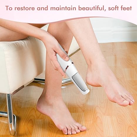 Electric Foot File and Callus Remover Electric Foot Files - Tophatter Daily Deals