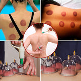 32 Cups Chinese Therapy Set Health & Wellness - Tophatter Daily Deals