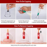 32 Cups Chinese Therapy Set Health & Wellness - Tophatter Daily Deals