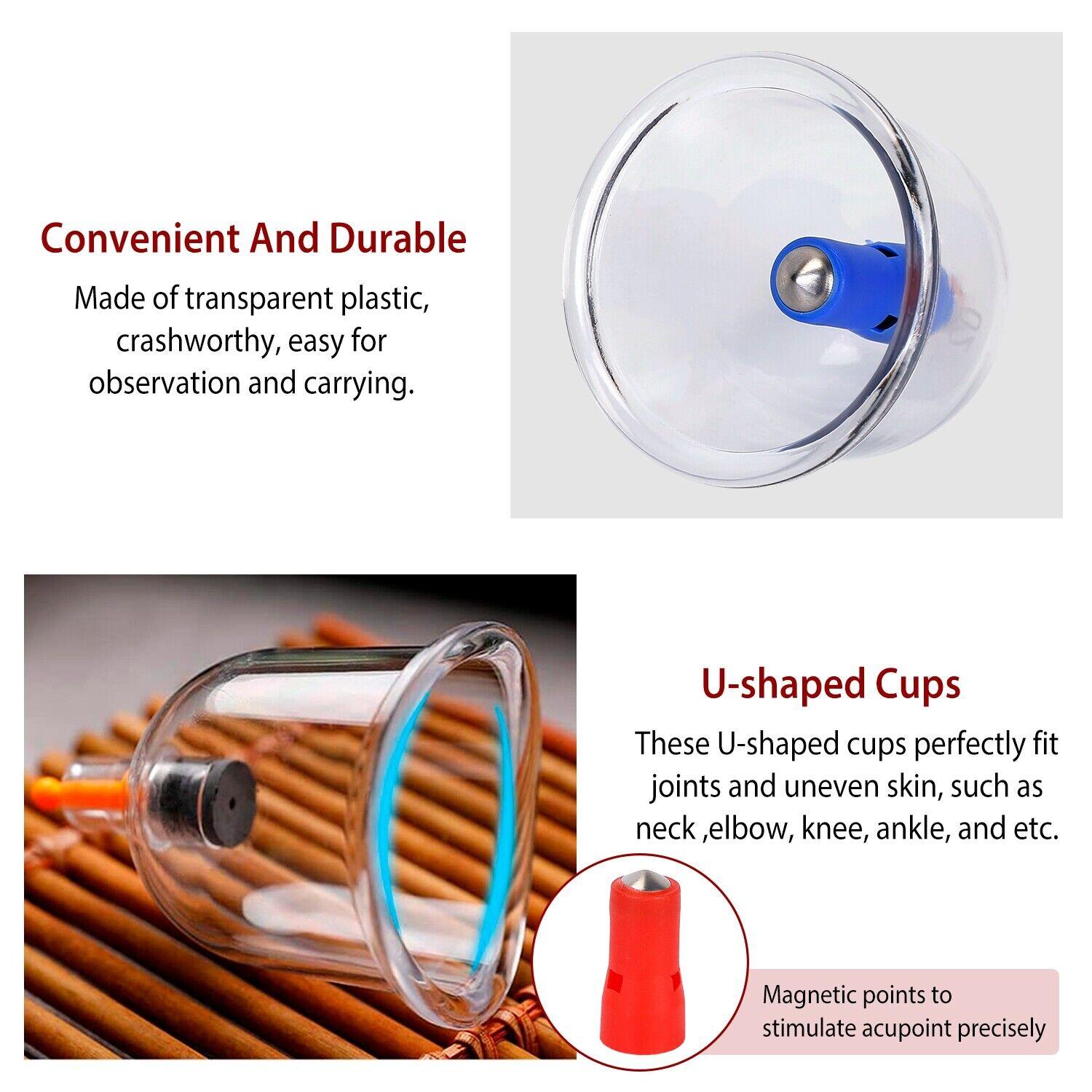 Cupping Therapy Set - 32PCS Cupping Vacuum Massage Cups Set Therapy Health Acupuncture Suction Magnet Apparel & Accessories - Tophatter Daily Deals