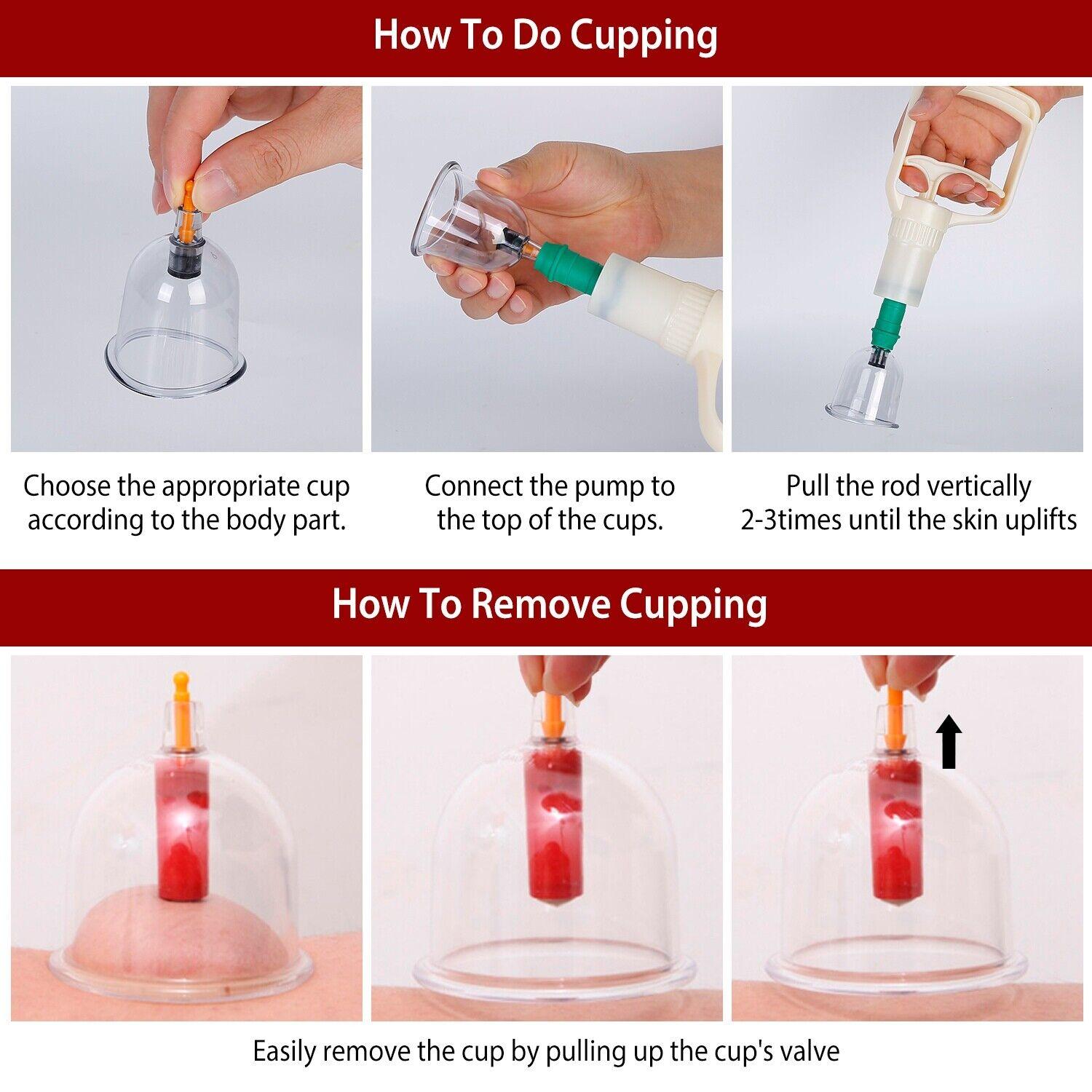 Cupping Therapy Set - 32PCS Cupping Vacuum Massage Cups Set Therapy Health Acupuncture Suction Magnet Apparel & Accessories - Tophatter Daily Deals