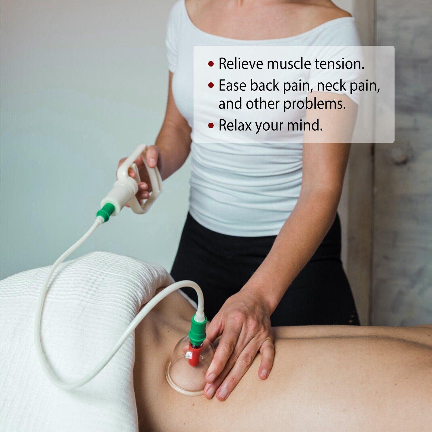 Cupping Therapy Set - 32PCS Cupping Vacuum Massage Cups Set Therapy Health Acupuncture Suction Magnet Apparel & Accessories - Tophatter Daily Deals