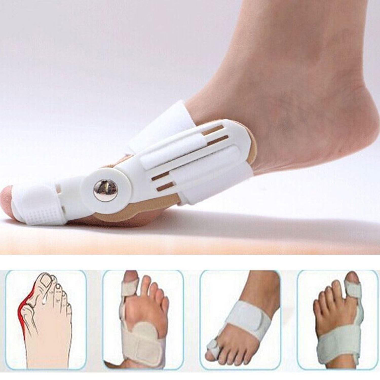 Bunion Corrector Toe Straightener Set - Toe Bunion Corrector Straightener Support Strap Orthopedic Uk Seller Health & Beauty - Tophatter Daily Deals