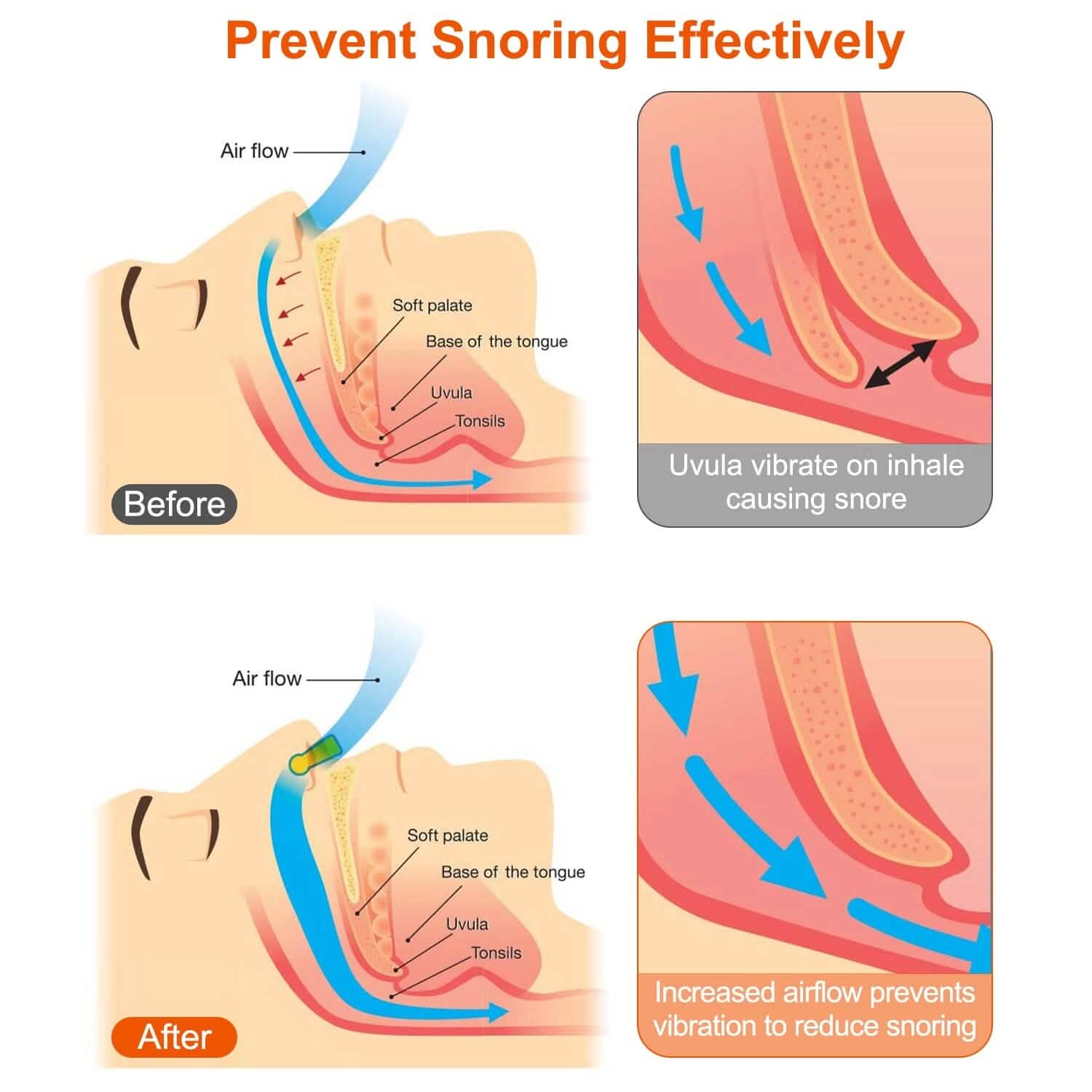 4-Pieces: Magnetic Nose Clip Anti Snoring Device Health & Wellness - Tophatter Daily Deals
