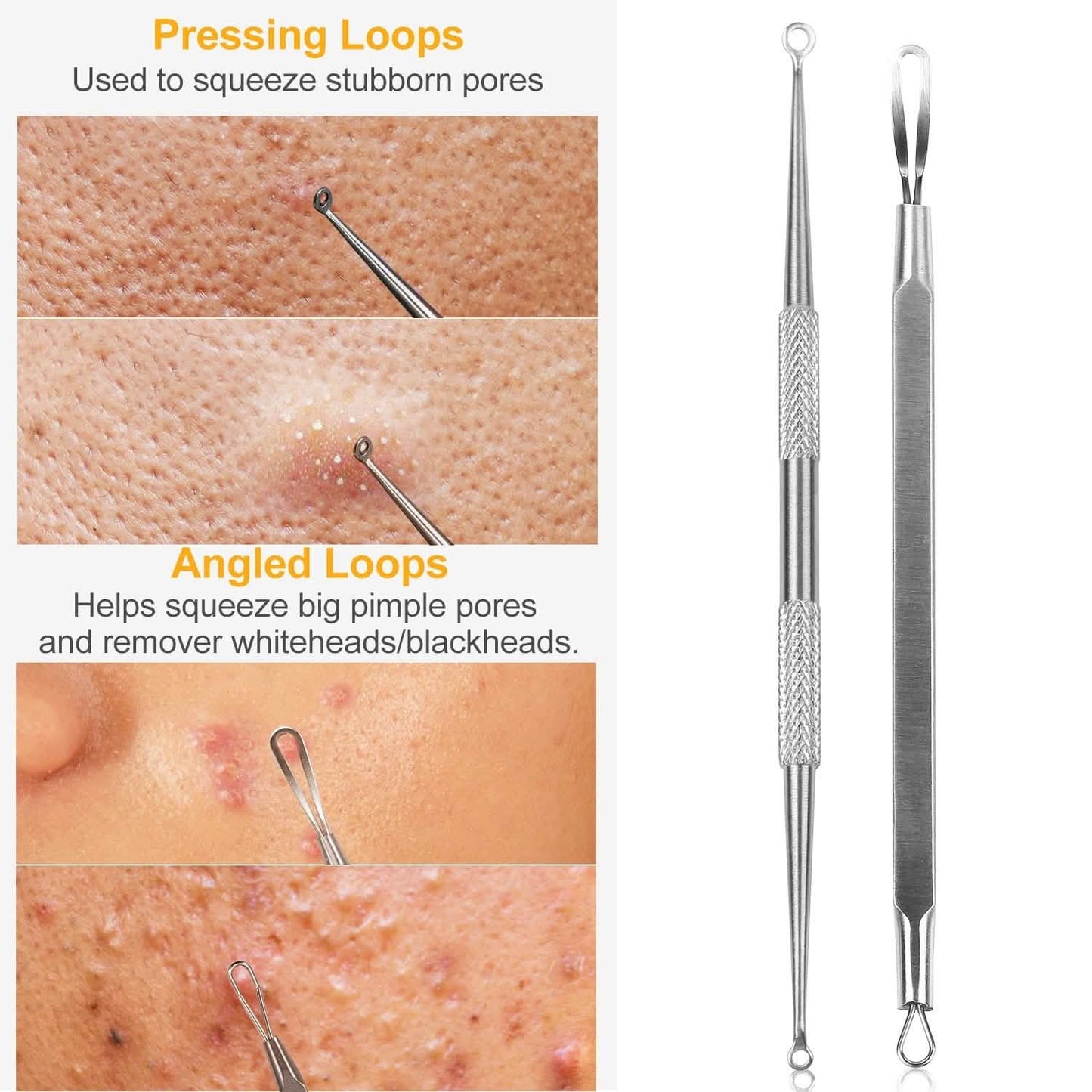 5-Piece Set: Blackhead Remover Kit Stainless Steel Popping Zit Remover Beauty & Personal Care - Tophatter Daily Deals