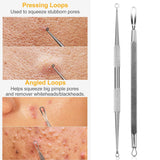 5-Piece Set: Blackhead Remover Kit Stainless Steel Popping Zit Remover Beauty & Personal Care - Tophatter Daily Deals