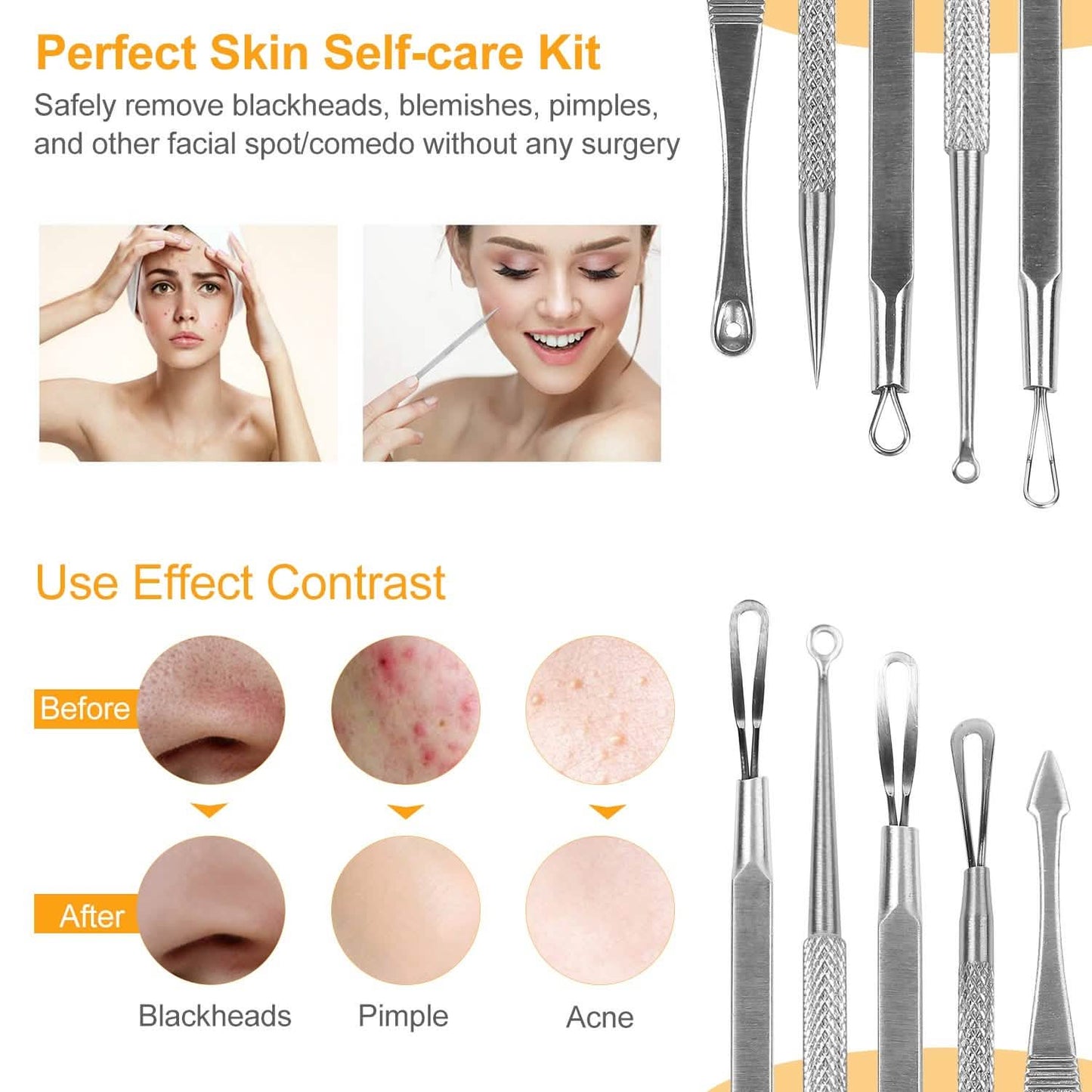 5-Piece Set: Blackhead Remover Kit Stainless Steel Popping Zit Remover Beauty & Personal Care - Tophatter Daily Deals