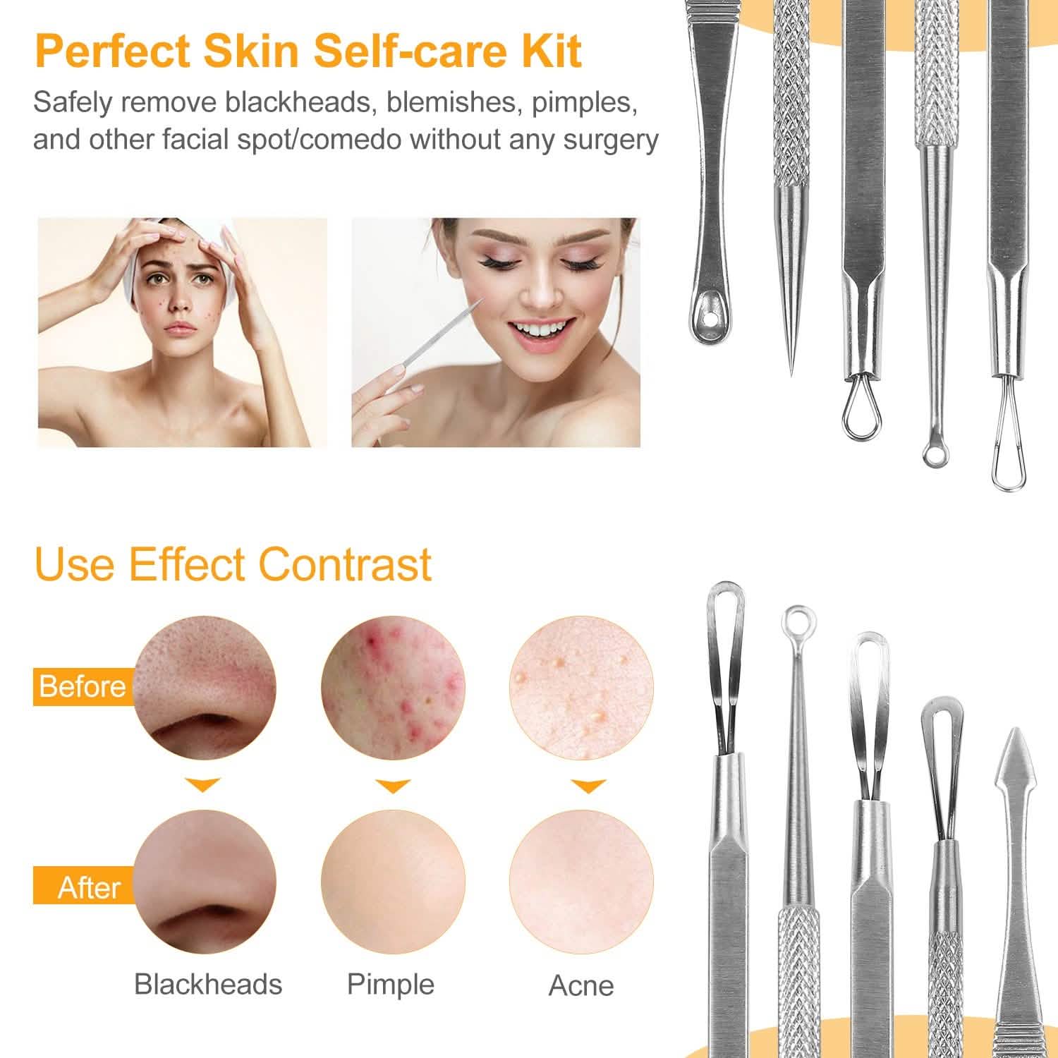 5-Piece Set: Blackhead Remover Kit Stainless Steel Popping Zit Remover Beauty & Personal Care - Tophatter Daily Deals