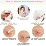 5-Piece Set: Blackhead Remover Kit Stainless Steel Popping Zit Remover Beauty & Personal Care - Tophatter Daily Deals