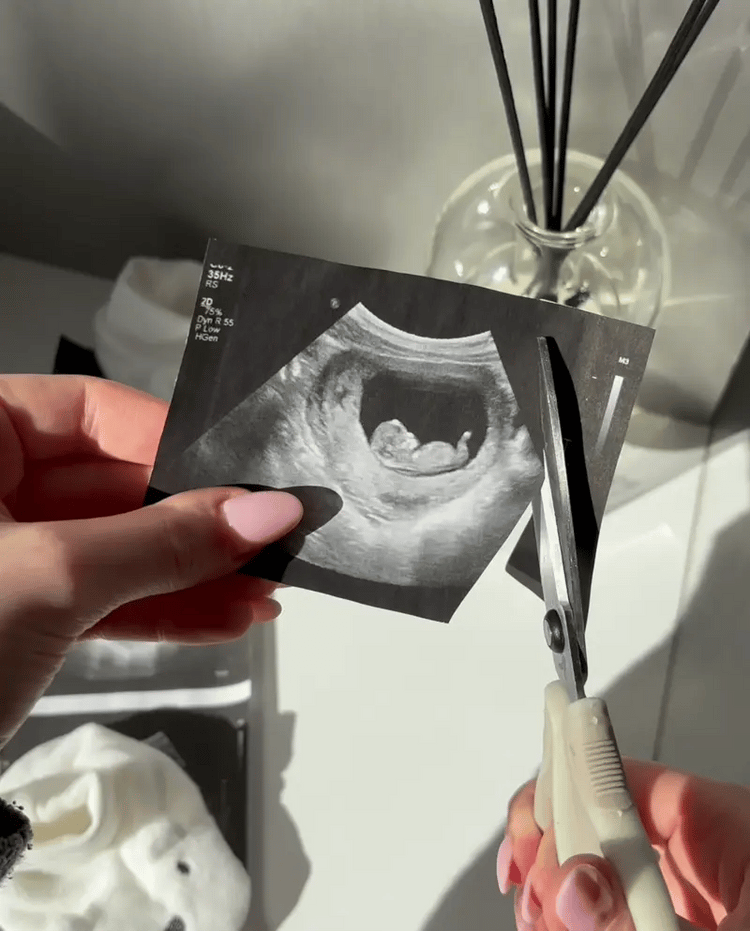 Baby Photo Frame - Tophatter Daily Deals