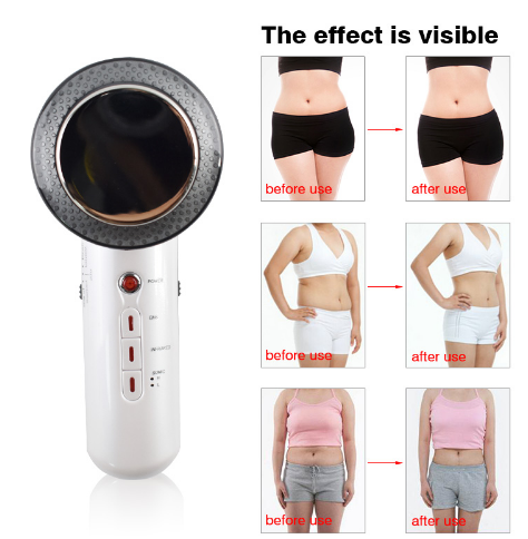 Beauty Care Slimming Device Handheld Ultrasound Body Fat Remove Massager 0 - Tophatter Daily Deals