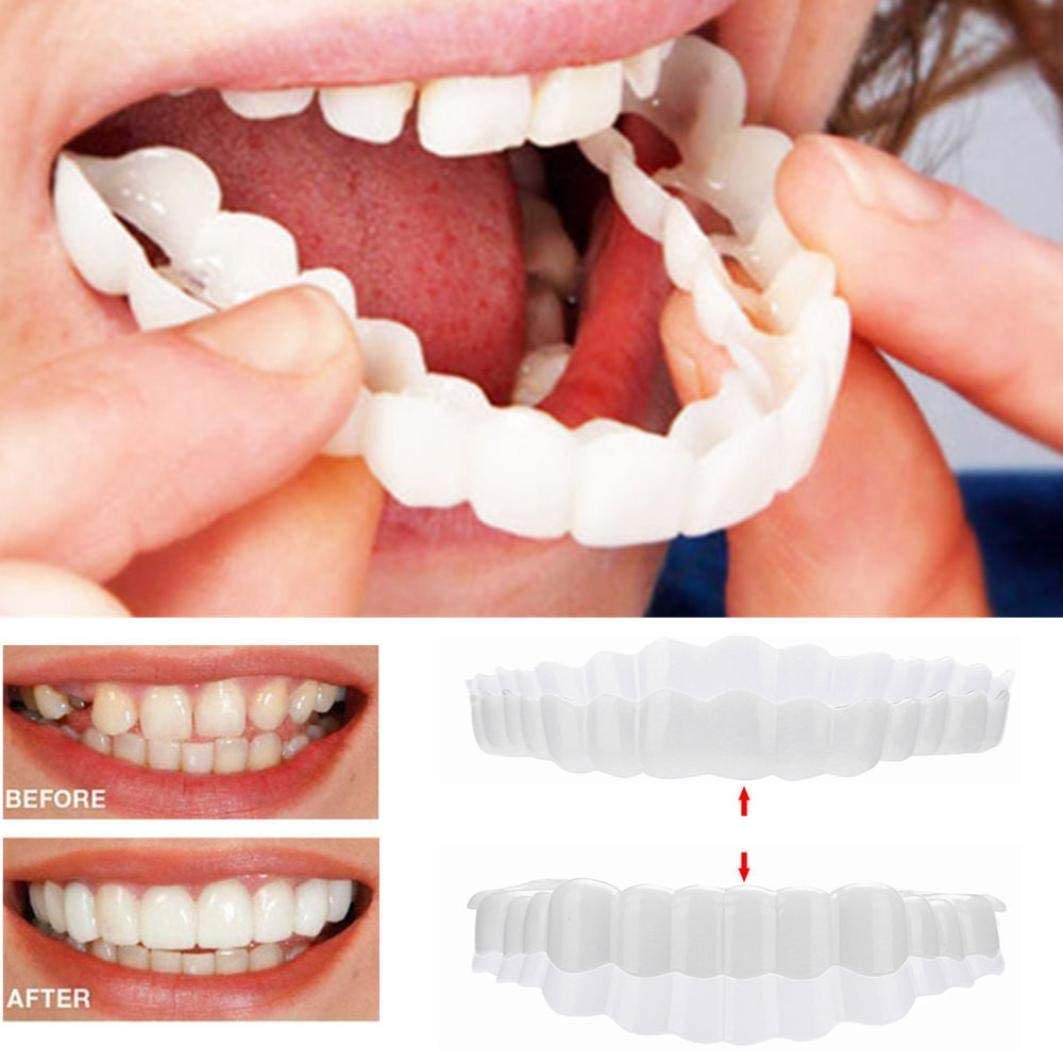 Smile Veneers Upper And Lower Instant Cover For All Day - Tophatter Daily Deals