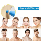 Skin Tag Removal Kit Blue Handheld At Home Fall 2025 - Tophatter Daily Deals
