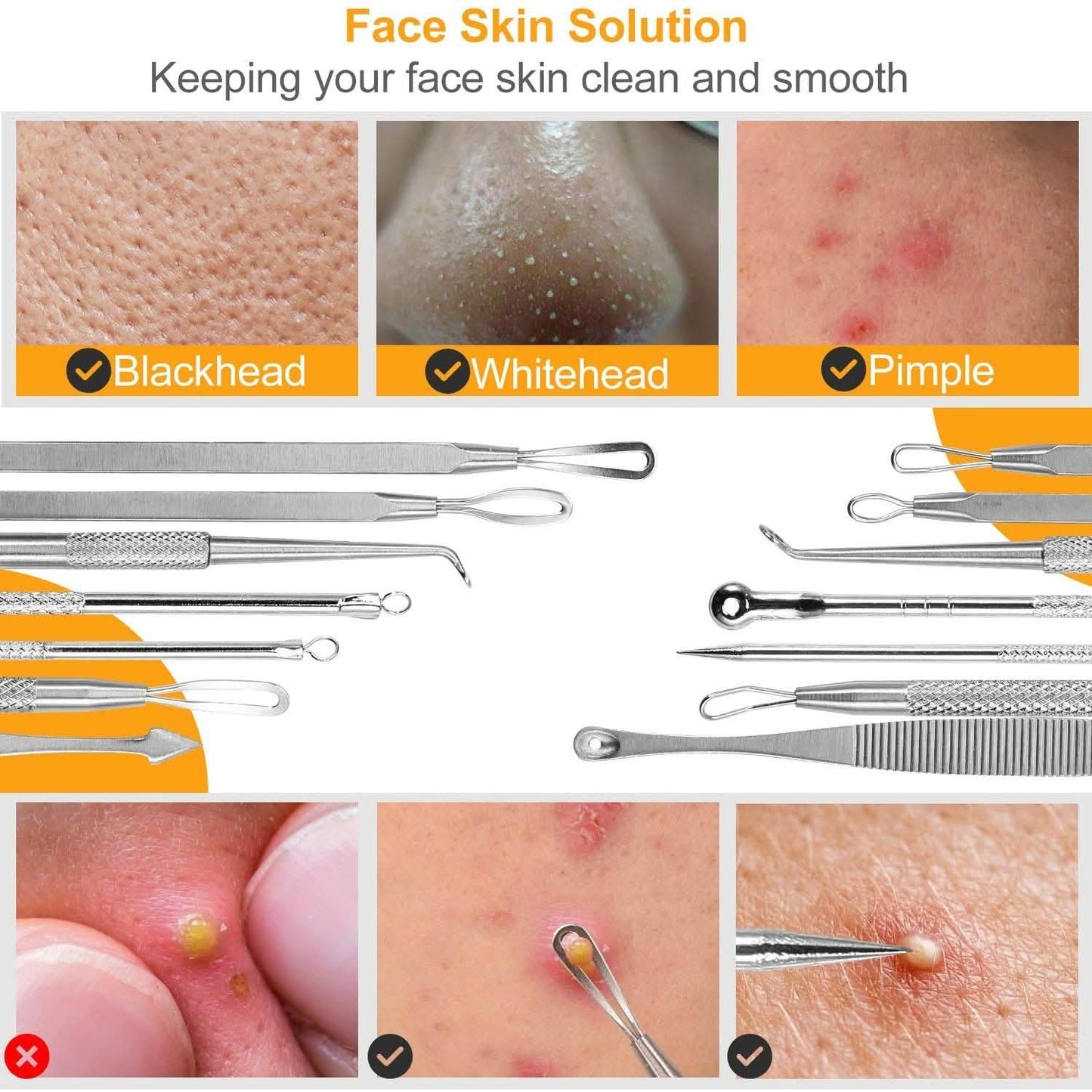 7-Pieces: Blackhead Remover Stainless Steel Beauty & Personal Care - Tophatter Daily Deals