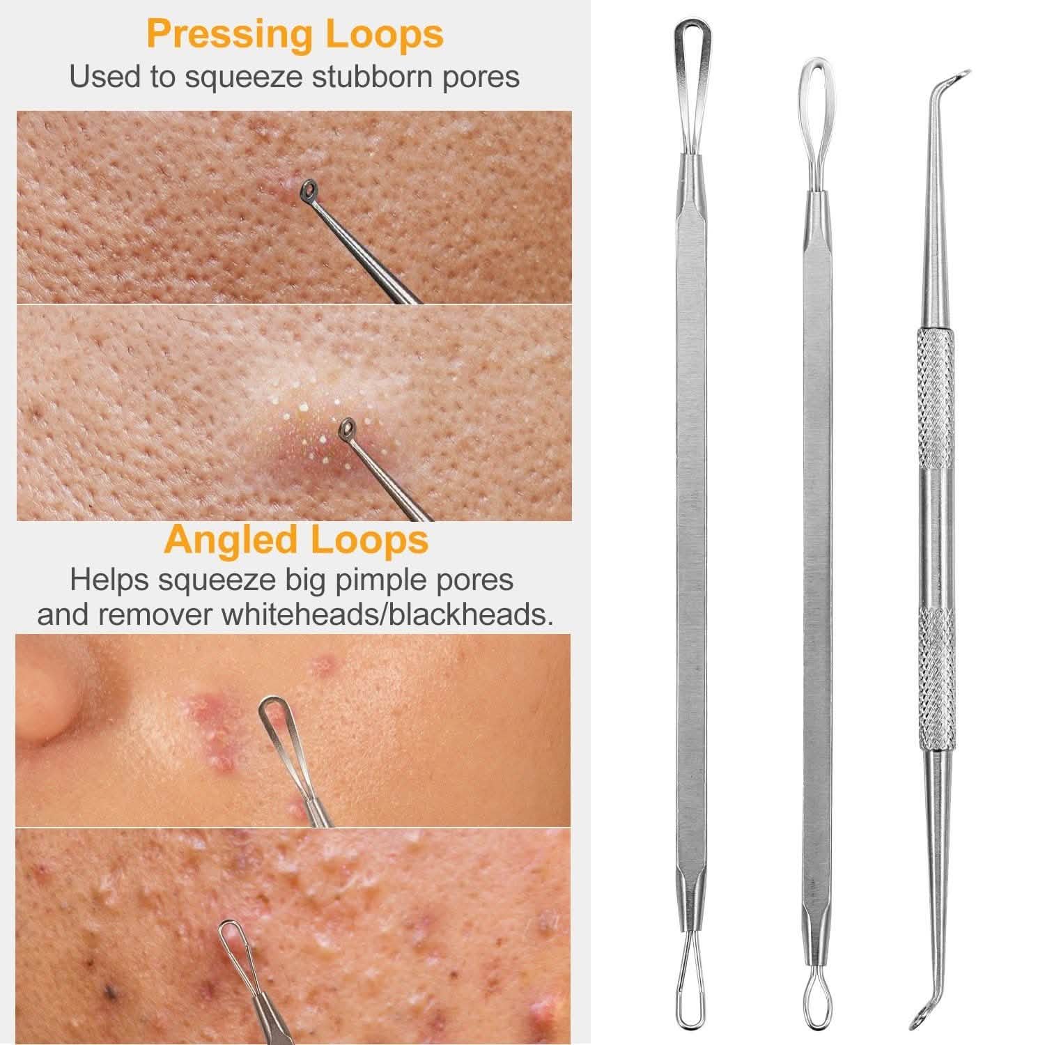7-Pieces: Blackhead Remover Stainless Steel Beauty & Personal Care - Tophatter Daily Deals