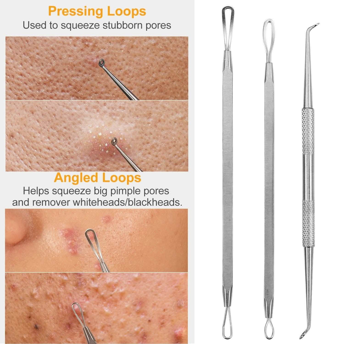 7-Pieces: Blackhead Remover Stainless Steel Beauty & Personal Care - Tophatter Daily Deals