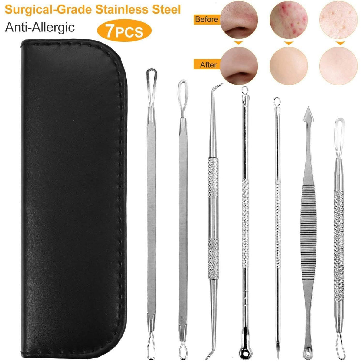 7-Pieces: Blackhead Remover Stainless Steel Beauty & Personal Care - Tophatter Daily Deals