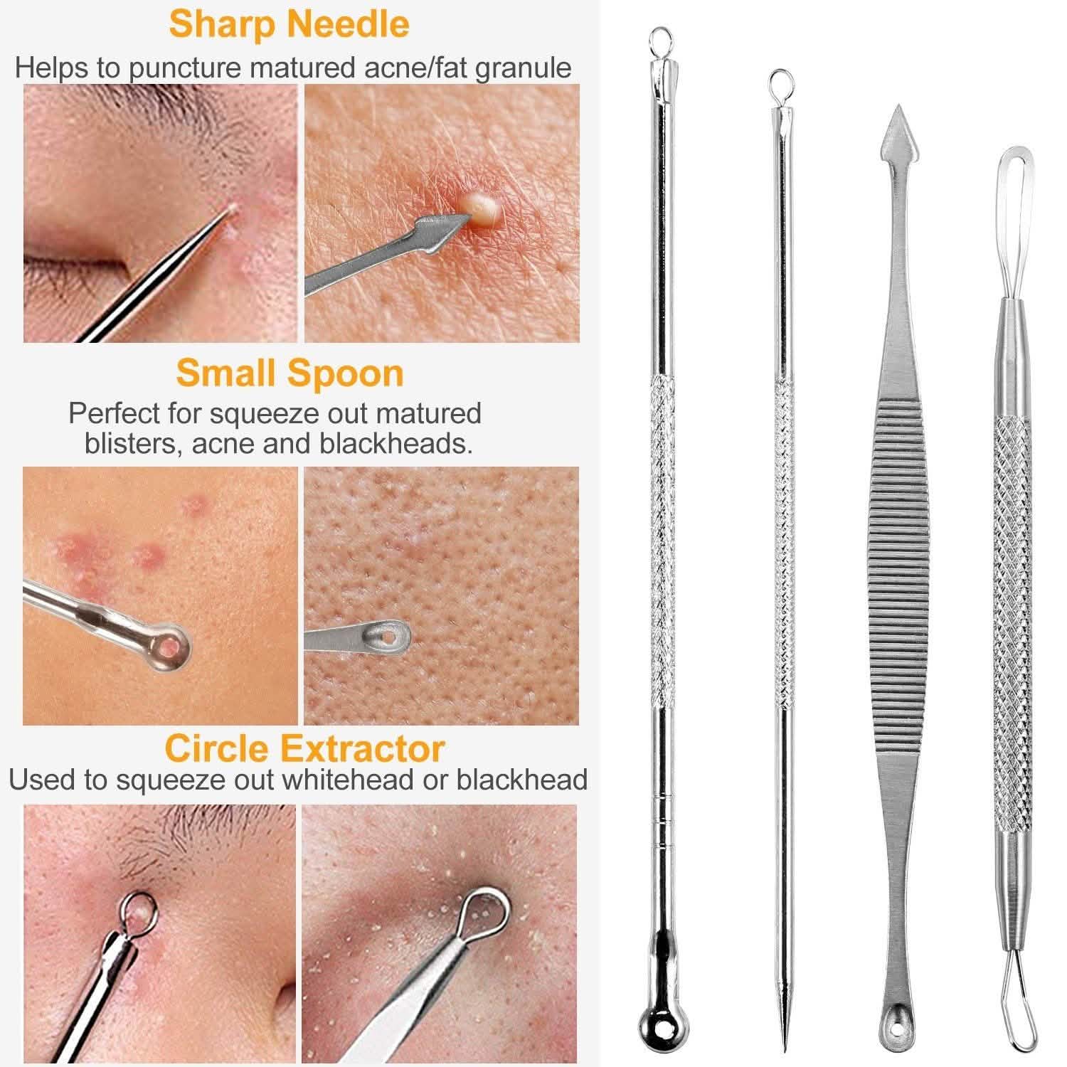 7-Pieces: Blackhead Remover Stainless Steel Beauty & Personal Care - Tophatter Daily Deals
