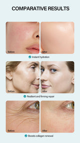 Anti-Wrinkle Face Cream Containing Hyaluronic Acid Hydrating High Moisturizing Fade French 0 - Tophatter Daily Deals