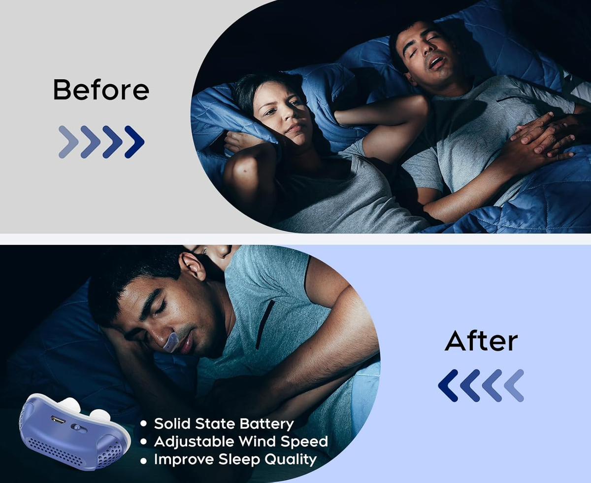 Travel Micro CPAP Alternative Nasal Bud Quiet Sleep Aid - Tophatter Daily Deals