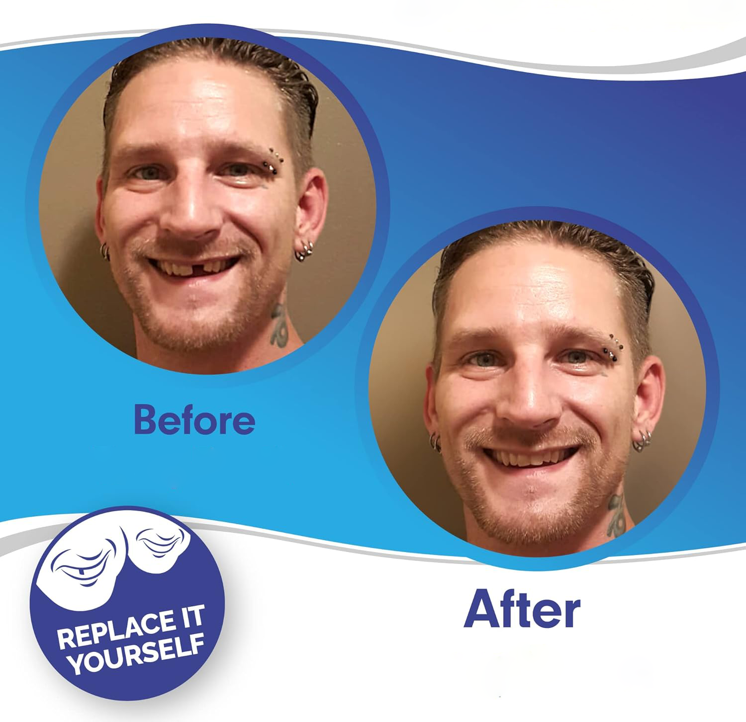 Smile Veneers Upper And Lower Instant Cover For All Day - Tophatter Daily Deals