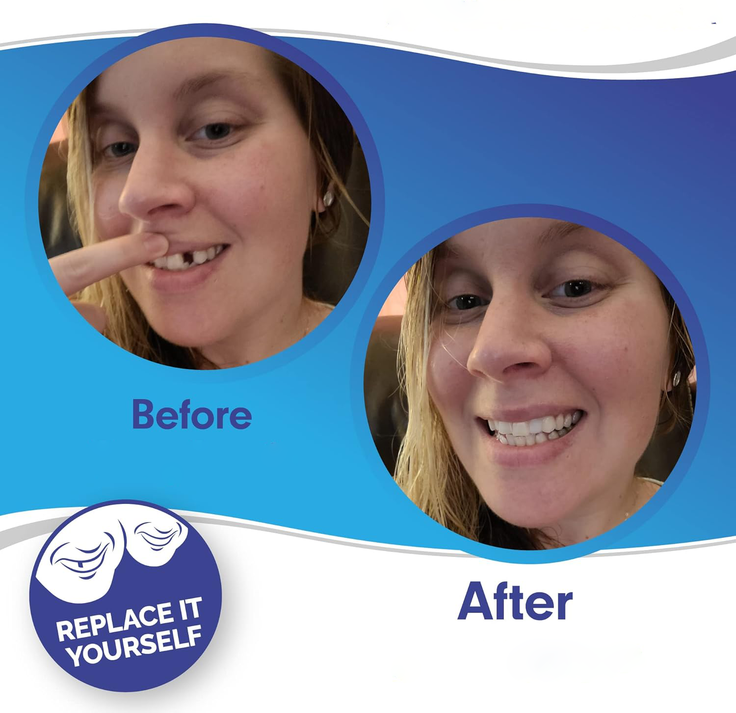 Smile Veneers Upper And Lower Instant Cover For All Day - Tophatter Daily Deals