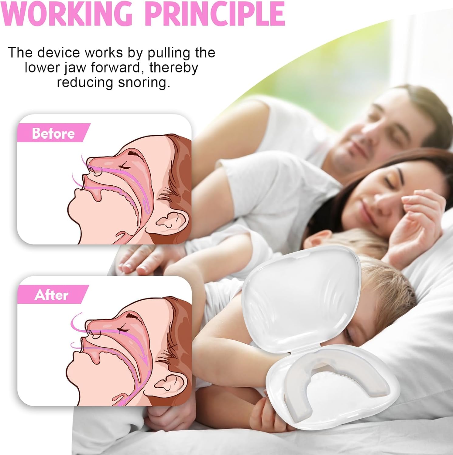 NoSnoring™ Anti-Snoring Mouth Guard Snoring & Sleep Apnea Aids - Tophatter Daily Deals