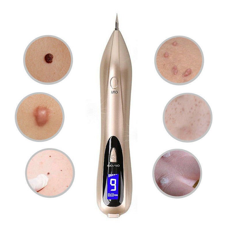 Mole Remover Pen At Home Skin Tag Removal Painless Fast - Tophatter Daily Deals