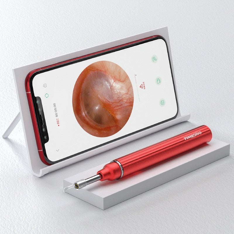 3.9mm WiFi Ear Cleaner Wax Removal Tool Ear Cleaning Camera Otoscope Wireless LED Light Oral Inspection For Android IOS 0 - Tophatter Daily Deals