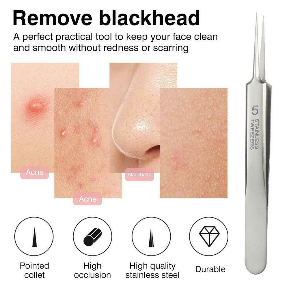 Blackhead Remover Needle - Acne Needle Kit Blackhead Remover Pimple Blemish Comedone Extractor Tweezer Tool Health & Beauty - Tophatter Daily Deals
