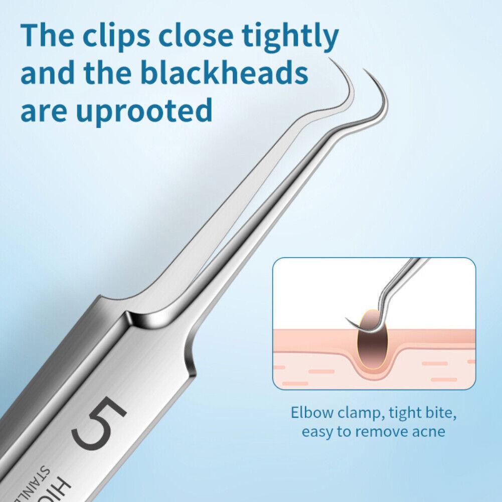 Blackhead Remover Needle - Acne Needle Kit Blackhead Remover Pimple Blemish Comedone Extractor Tweezer Tool Health & Beauty - Tophatter Daily Deals