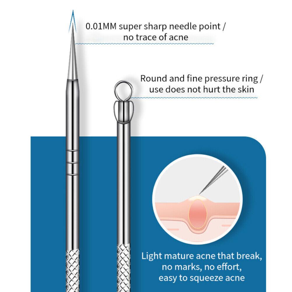 Blackhead Remover Needle - Acne Needle Kit Blackhead Remover Pimple Blemish Comedone Extractor Tweezer Tool Health & Beauty - Tophatter Daily Deals