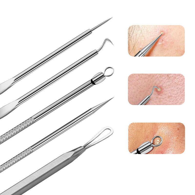Blackhead Remover Needle - Acne Needle Kit Blackhead Remover Pimple Blemish Comedone Extractor Tweezer Tool Health & Beauty - Tophatter Daily Deals