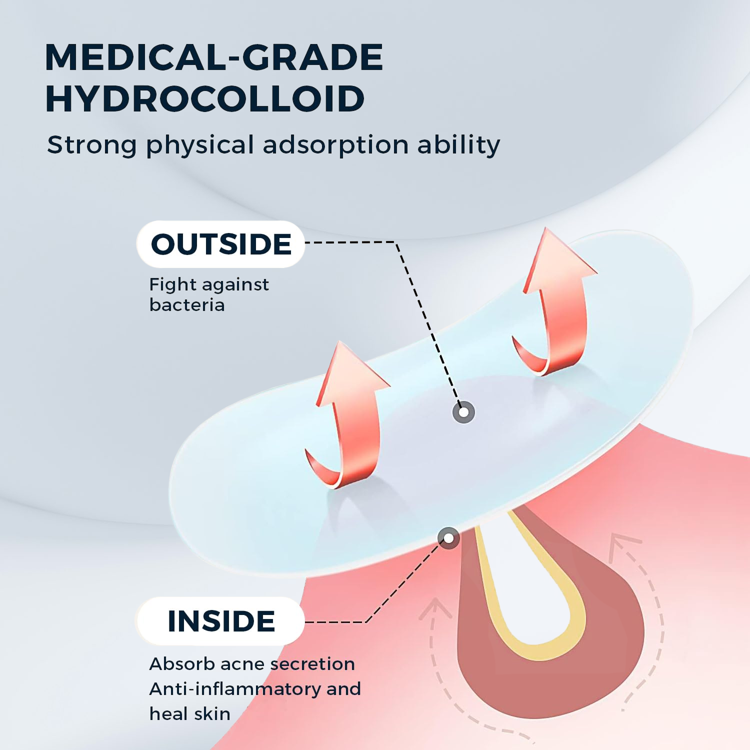 Clear Pimple Patch - 36pcs Sheet Acne Patch Tag Hydrocolloid Pimple Spot Acne Healing Dots Personal Care - Tophatter Daily Deals