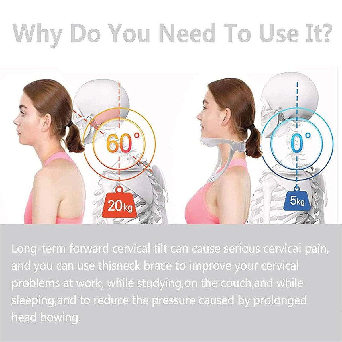 Neck Brace for Posture - Adjustable Neck Stretcher Neck Support for Cervical Pain Relief Neck Traction Device Personal Care - Tophatter Daily Deals