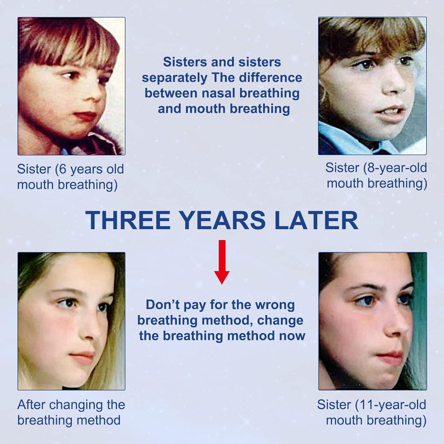 Mouth Taping for Sleep - Better Nose Breathing Instant Snoring Relief Strips Gentle Mouth Tape Personal Care - Tophatter Daily Deals