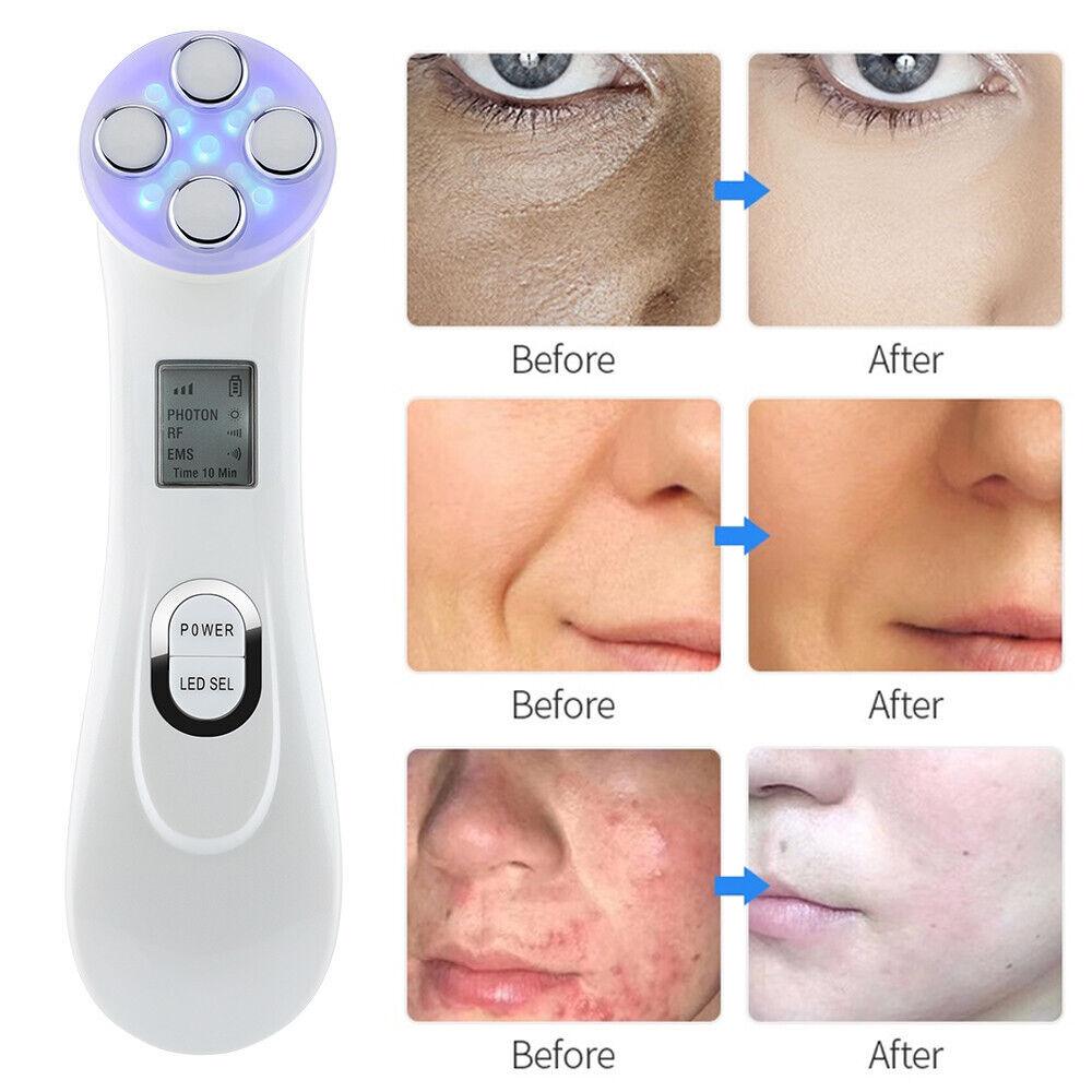 Face Tightener Machine - 5 in1 LED RF Skin Beauty Instrument Ultrasonic Face Massager Anti-aging Device Health & Beauty - Tophatter Daily Deals
