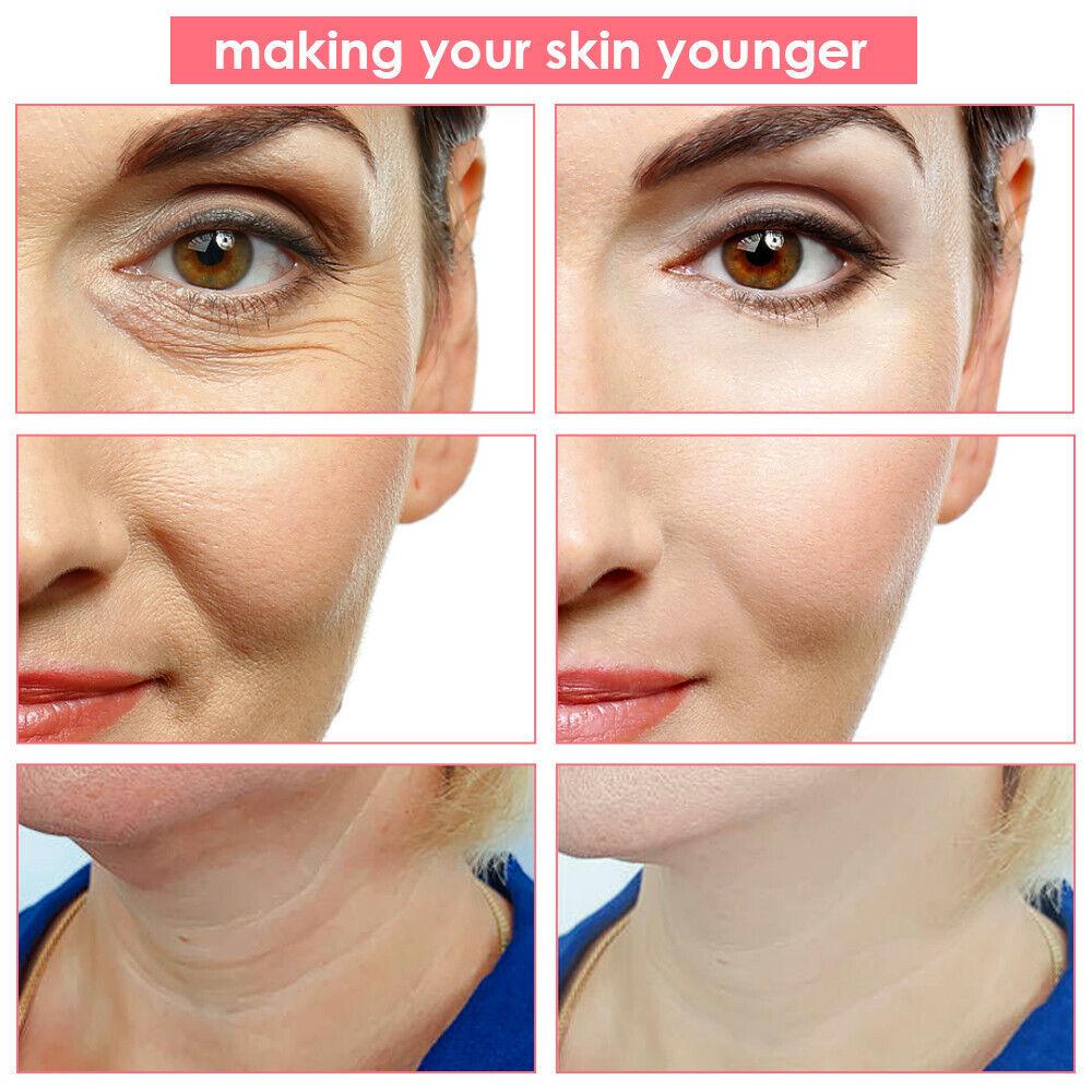 Face Tightener Machine - 5 in1 LED RF Skin Beauty Instrument Ultrasonic Face Massager Anti-aging Device Health & Beauty - Tophatter Daily Deals