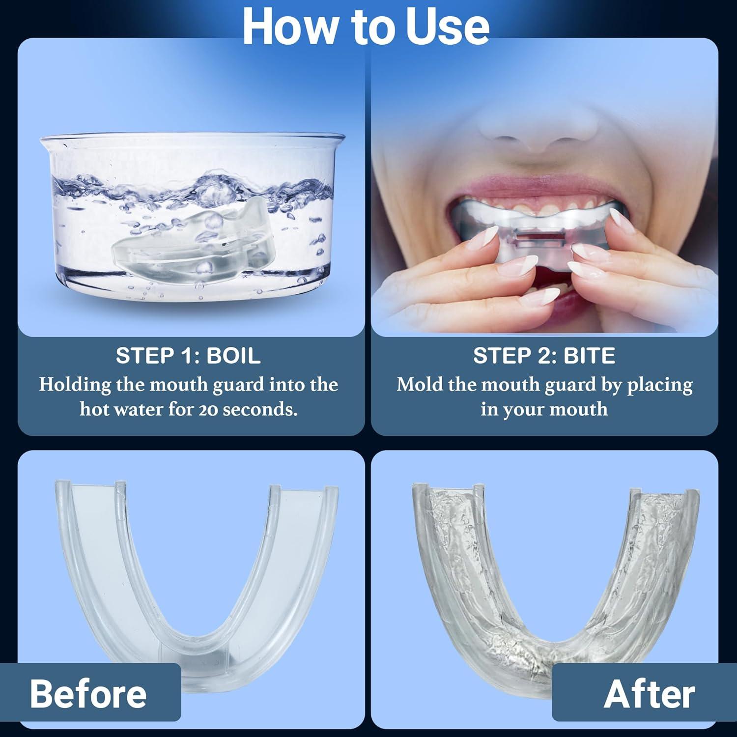 Mouthguard for Snoring - NHS Snore Stopper Anti Snoring Mouth Guard Device Sleep Aid Stop Apnoea Health & Beauty - Tophatter Daily Deals