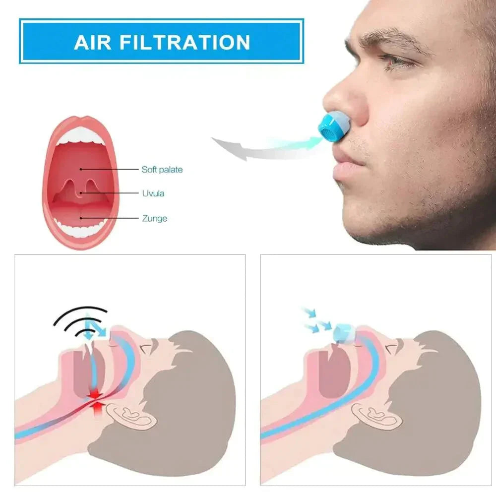 Micro CPAP Travel Machine Hoseless Anti Snoring Device - Tophatter Daily Deals