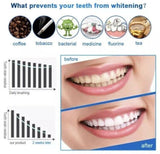Teeth Whitening Strips - 28 Professional Advanced Teeth Whitening Strips Home Tooth Bleaching UK Non Toxic - Sensitivity Free Health Care - Tophatter Daily Deals